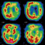 neuroimaging