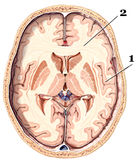 Substance blanche - Neuromedia