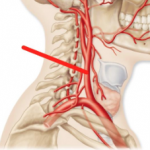 L'artère carotide principale (flèche rouge)