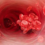 thrombose sang