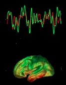 EEG_MRI
