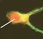 Alpha-synucléine (en rouge) à l'intérieur d'un corps cellulaire d'un neurone.
