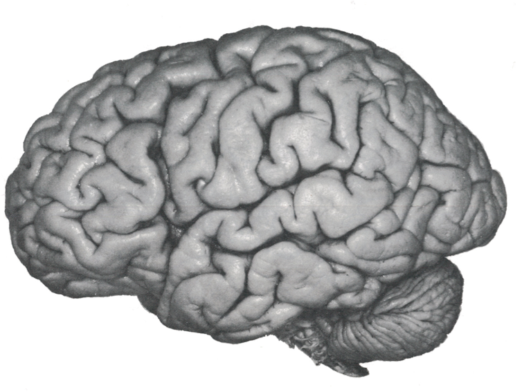 The human brain. 